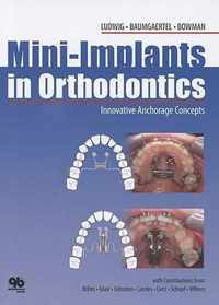 Mini-implants in Orthodontic