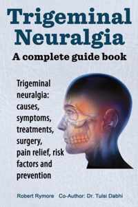 Trigeminal Neuralgia