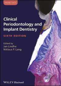 Clinical Periodontology and Implant Dentistry, 2 Volume Set