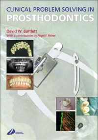 Clinical Problem Solving in Prosthodontics