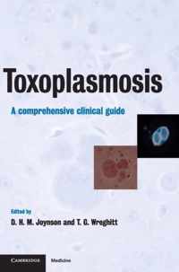 Toxoplasmosis