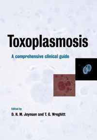 Toxoplasmosis