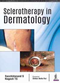 Sclerotherapy in Dermatology