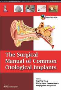 The Surgical Manual of Common Otological Implants