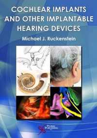 Cochlear Implants and Other Implantable Hearing Devices