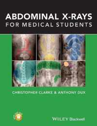 Abdominal X Rays For Medical Students