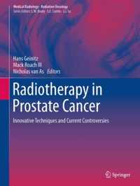 Radiotherapy in Prostate Cancer