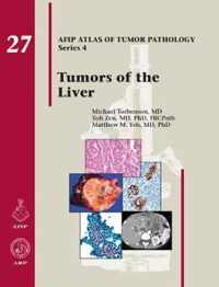 Tumors of the Liver