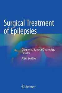 Surgical Treatment of Epilepsies