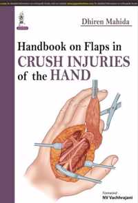 Handbook on Flaps in Crush Injuries of the Hand