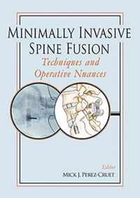 Minimally Invasive Spine Fusion