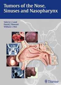 Tumors Of The Nose, Sinuses, And Nasopharynx