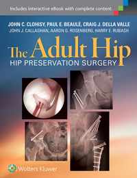 The Adult Hip