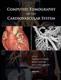 Computed Tomography of the Cardiovascular System