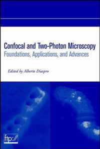 Confocal and Two-Photon Microscopy