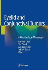 Eyelid and Conjunctival Tumors