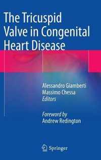 The Tricuspid Valve in Congenital Heart Disease