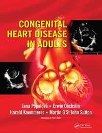 Congenital Heart Disease in Adults