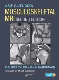 Musculoskeletal MRI