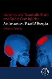 Ischemic and Traumatic Brain and Spinal Cord Injuries