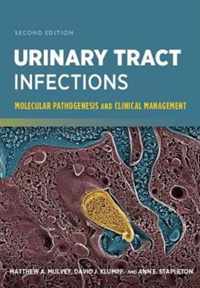 Urinary Tract Infections: Molecular Pathogenesis and Clinical Management