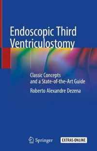 Endoscopic Third Ventriculostomy