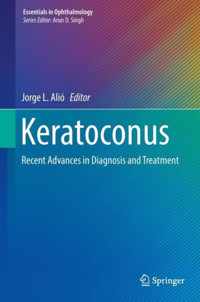 Keratoconus