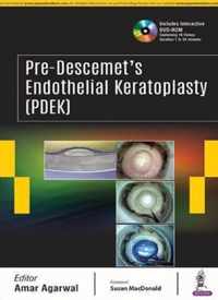 Pre-Descemet's Endothelial Keratoplasty (PDEK)