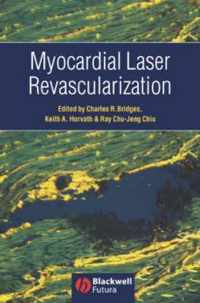 Myocardial Laser Revascularization