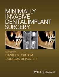 Minimally Invasive Dental Implant Surgery