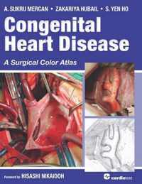 Congenital Heart Disease