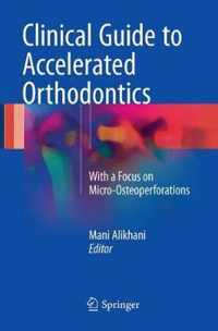 Clinical Guide to Accelerated Orthodontics