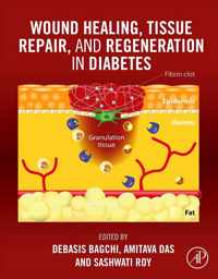 Wound Healing, Tissue Repair, and Regeneration in Diabetes