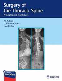 Surgery of the Thoracic Spine