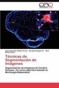 Tecnicas de Segmentacion de Imagenes