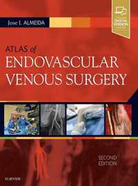 Atlas of Endovascular Venous Surgery