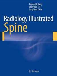 Radiology Illustrated Spine