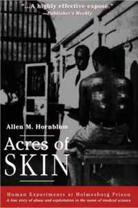 Acres of Skin