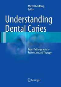 Understanding Dental Caries