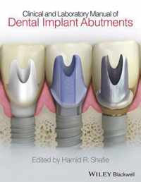 Clinical and Laboratory Manual of Dental Implant Abutments