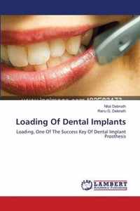 Loading Of Dental Implants