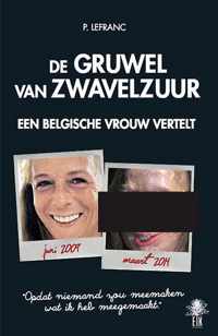 De gruwel van zwavelzuur