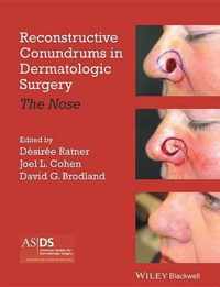 Reconstructive Conundrums in Dermatologic Surgery