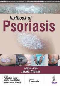 Textbook of Psoriasis