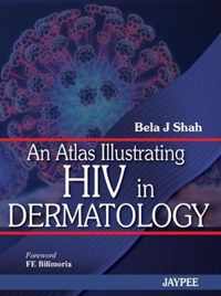 An Atlas Illustrating HIV in Dermatology