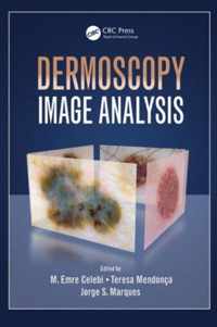 Dermoscopy Image Analysis