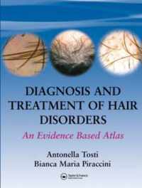 Diagnosis and Treatment of Hair Disorders