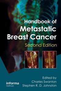 Handbook of Metastatic Breast Cancer