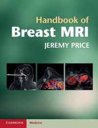 Handbook of Breast MRI