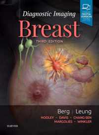 Diagnostic Imaging: Breast